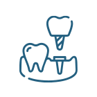 Dental Implant